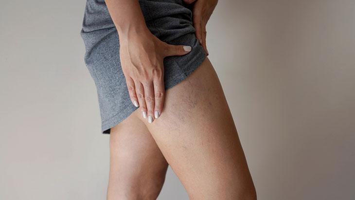 Sonbahar ve kış ayları tedavide avantaj sağlıyor