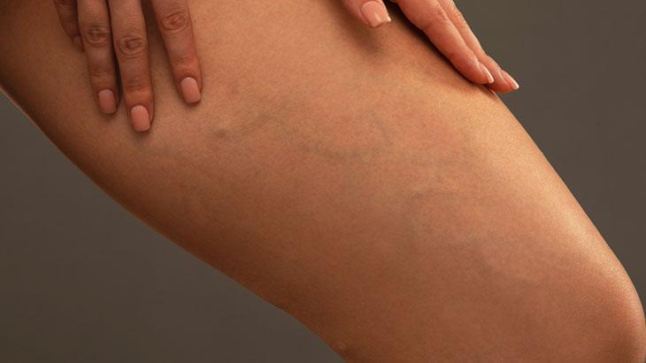 Varise karşı 8 etkili önlem