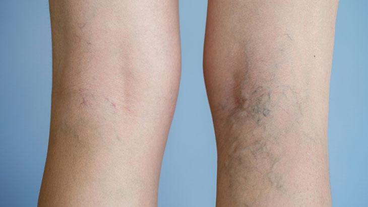 5- Su tüketimine dikkat edin