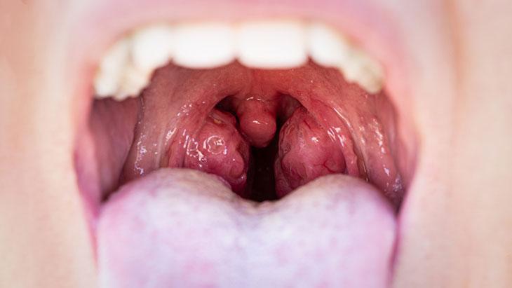 Bu belirtilerle kendini gösteriyor