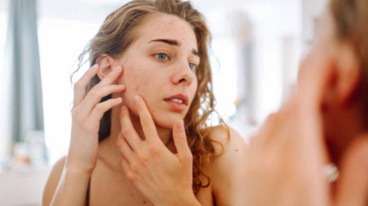 Kışın kuruyan ciltler için bu karışım birebir Tahil ve bal mucizesi