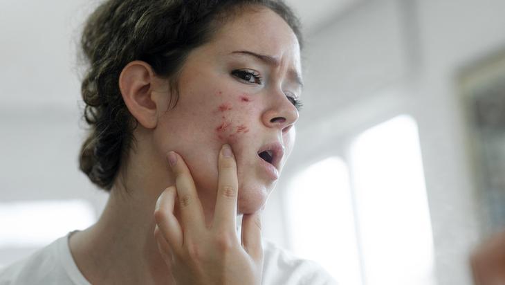 4 malzemeyle leke açıcı serum Kullanırken bu etkilere dikkat edin