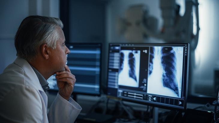 ‘50 yaşın üzerinde olup sigara içenlere tomografi öneriyoruz’ ‘50 yaşın üzerinde olup sigara içenlere tomografi öneriyoruz’