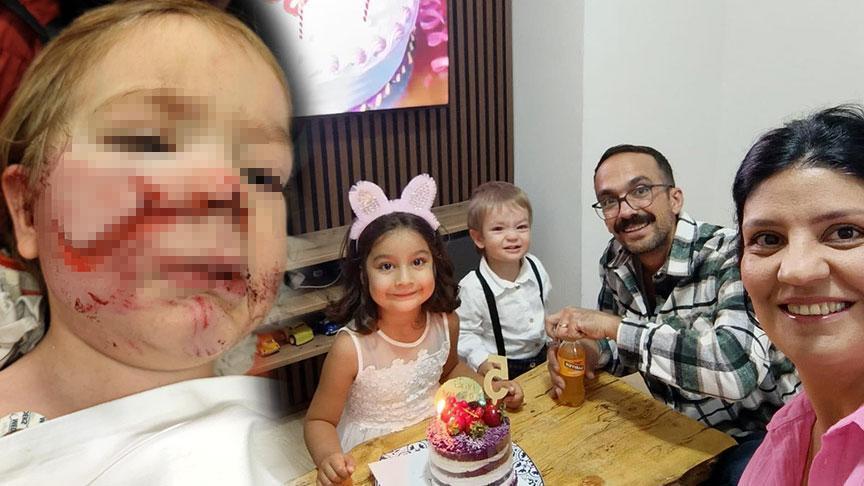 Ankara 1,5 ve 5 yaşındaki çocuklara pitbull saldırdı! Şok detaylar: 'Tasmasını açıp, ısırtmakla tehdit etmiş'