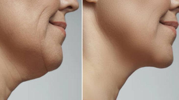 3 hafta içinde gıdıyı yok eden egzersiz Evde yapılıyor, saniyeler sürüyor