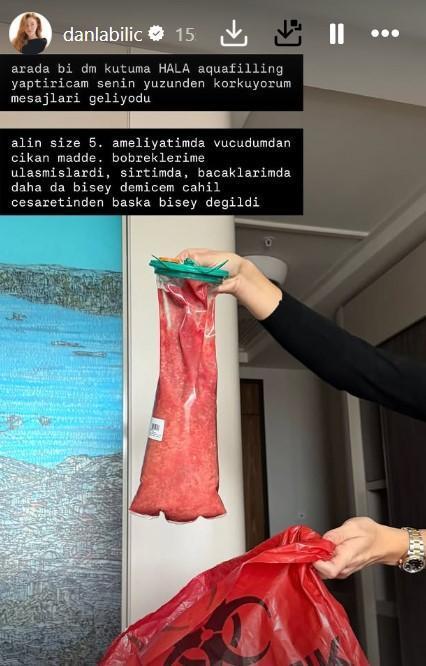 BÖBREKLERİME ULAŞMIŞLARDI