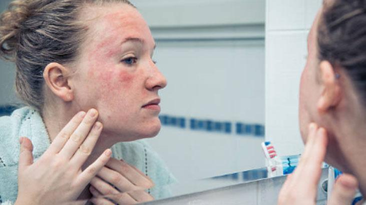 Egzama ve kuruluğa doğal retinol Cildi canlandıran ürünün tek damlası yetiyor