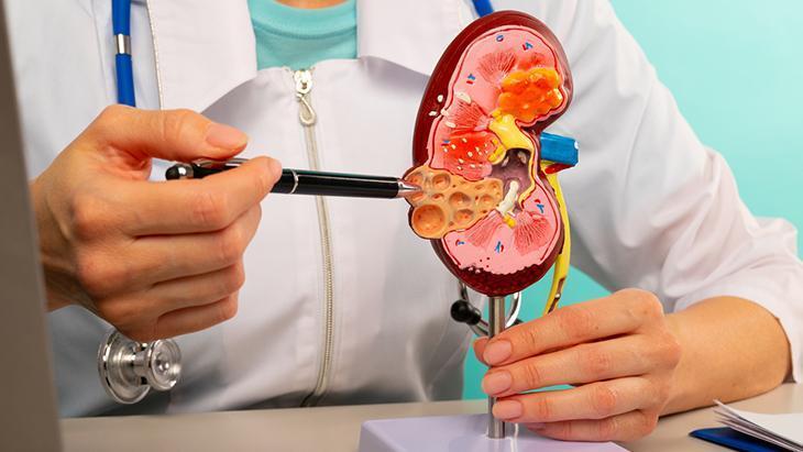 Uzmanından böbrek taşının belirtisi herkeste farklıdır uyarısı