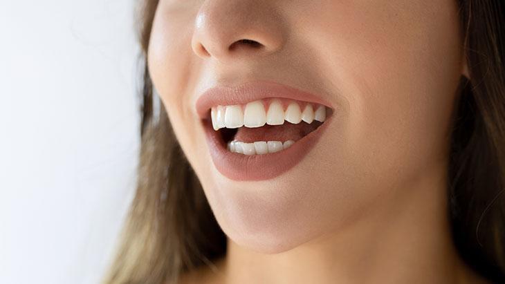 Bazı renk değişiklikleri karbonat ile düzelmez