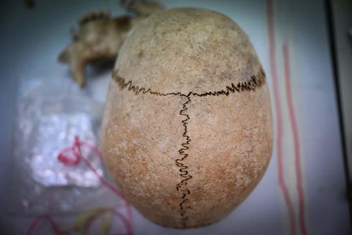 12 bin yıllık sır çözülüyor Diyarbakır’da ilk insanların DNA haritası çıkarılıyor