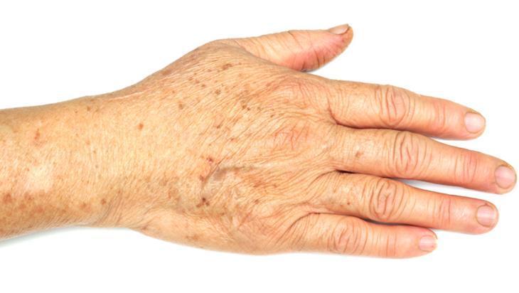 Gece sür, sabah farkı gör Çatlayan elleri onaran doğal karışım Gece sür, sabah farkı gör Çatlayan elleri onaran doğal karışım