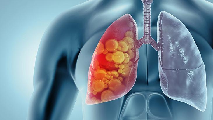 ‘TÜRKİYE’DE KONTROL ALTINDA AMA DİKKATLİ OLMALIYIZ’