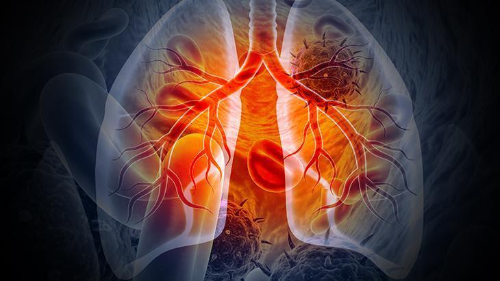 ‘TEDAVİ MÜMKÜN, DÜZENLİ TAKİP ŞART’