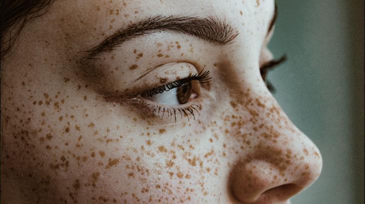 Çillerini yok etmek isteyenlere müjde İbn-i Sinadan lazere meydan okuyan asırlık reçete