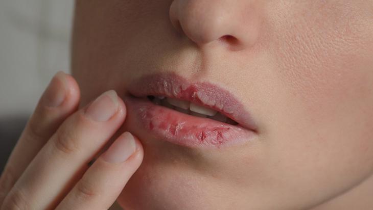 Piyasadakileri unutturan ev yapımı lip gloss Dudakları ışıl ışıl yapıyor