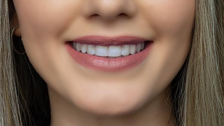 Cilt eşitleyip kararmaları gideriyor Dudak kenarındaki renk eşitsizliğine son