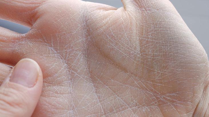 Kışın çatlayan elleri pamuk gibi yapıyor 1 kaşıkta yumuşacık