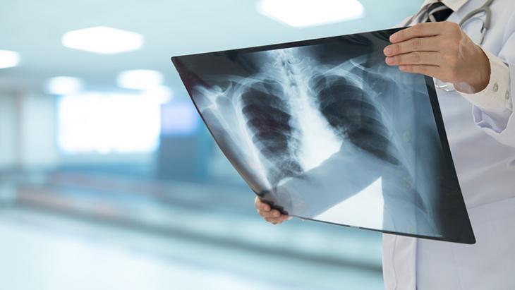 DİNLENMEK ÇOK ÖNEMLİ