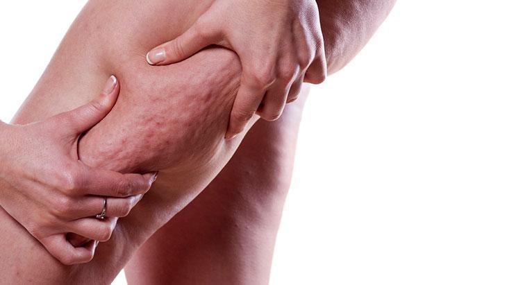 Kilo artışı şikayetleri ağırlaştırıyor