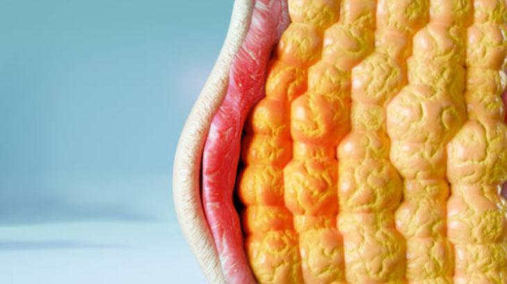 Kat kat giyiyoruz ama nafile Vücudun gizli kaloriferi buymuş