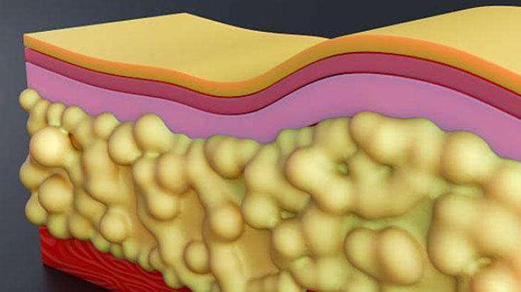 Kat kat giyiyoruz ama nafile Vücudun gizli kaloriferi buymuş