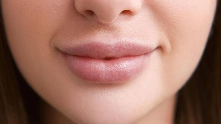 İğne yok, kimyasal yok Dudakları doğal yollarla dolgunlaştıran baharat