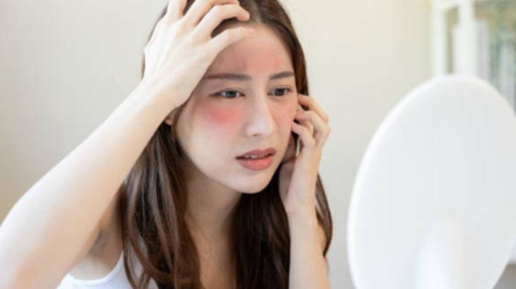 Öbek öbek çıkıyordu Cilt kızarıklığı için tek hamle: 2 hafta bu serumu sürdüm Öbek öbek çıkıyordu Cilt kızarıklığı için tek hamle: 2 hafta bu serumu sürdüm