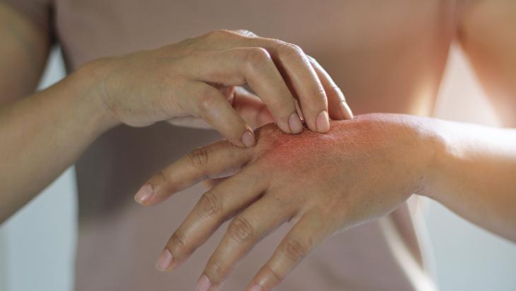 Eldeki çatlakları bir gecede pamuk gibi yapıyor Cilt üzerinde bariyer etkisi Eldeki çatlakları bir gecede pamuk gibi yapıyor Cilt üzerinde bariyer etkisi