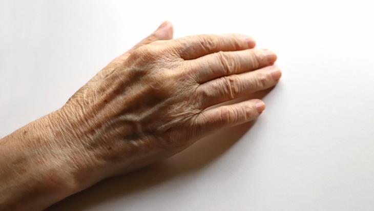 Eldeki çatlakları bir gecede pamuk gibi yapıyor Cilt üzerinde bariyer etkisi Eldeki çatlakları bir gecede pamuk gibi yapıyor Cilt üzerinde bariyer etkisi