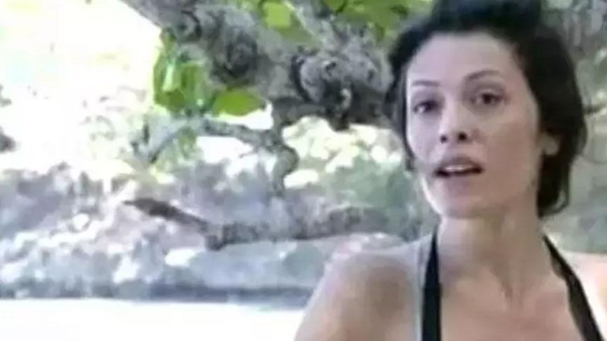 Eski Survivor yarışmacısının inanılmaz değişimi: ‘Yüz naklimin 16. günü’ deyip paylaştı
