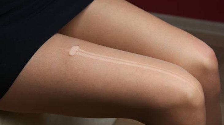 Kaçan ve yırtılan külotlu çorapları çöpe atmayın Tek fısla kullanılıyor, daha sağlam