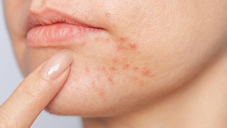 “Cilt sağlığı için bütüncül yaklaşım şart” “Cilt sağlığı için bütüncül yaklaşım şart”