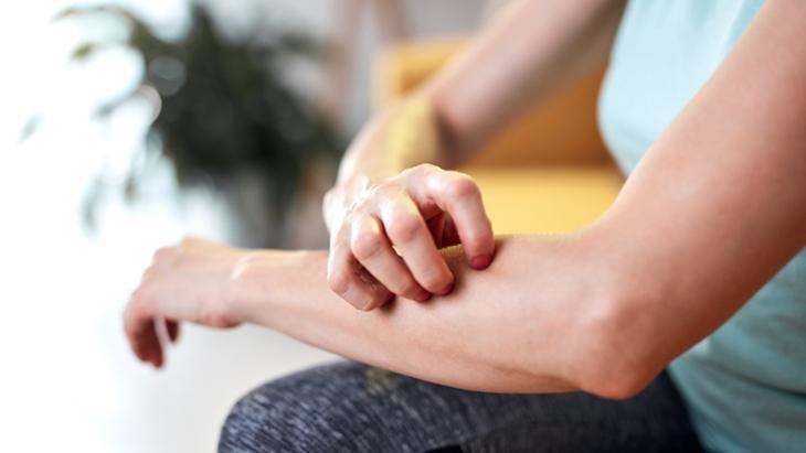 Meğer egzamanın başlangıcı böyleymiş Kaşıntıyı önemseyin