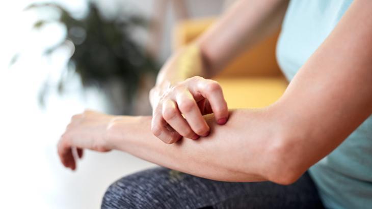 Meğer egzamanın başlangıcı böyleymiş Kaşıntıyı önemseyin