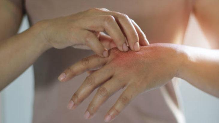 Kuru soğuktan kurtaran formül Ellerinizi neme doyuracak, çatlama derdine son