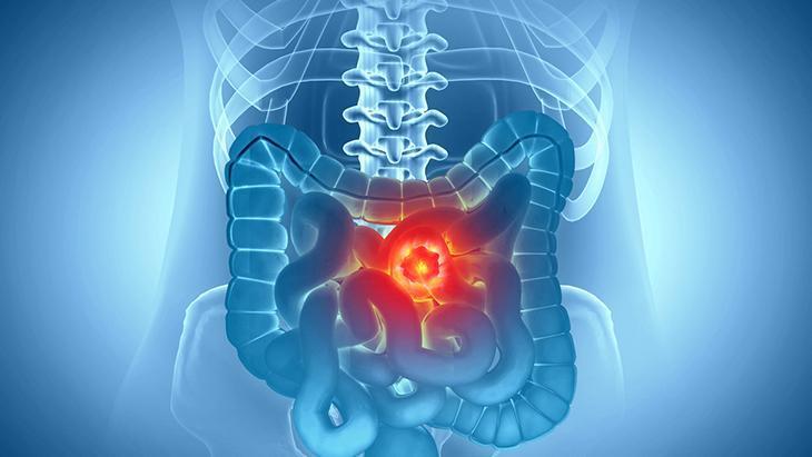 Belirtiler göz ardı edilmemeli