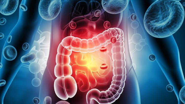 Evreleme ve tedavi planı hayati önem taşıyor