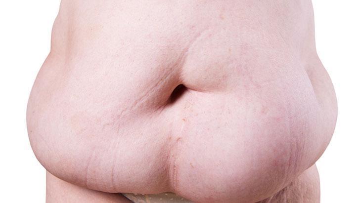 Dev fıtıklarda yeni tedavi dönemi