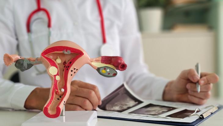 Adet sancısını ‘normal’ sanmayın: Endometriozis uyarısı