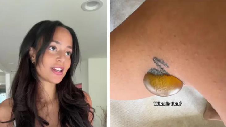 Sildirmek isteyenler bir kez daha düşünsün! Fenomenin yaşadığı olay herkesi şok etti