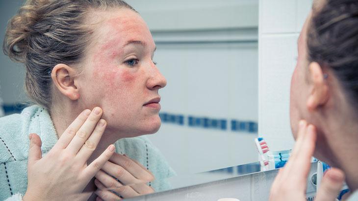 1-Cildinizi günde iki kez temizleyin