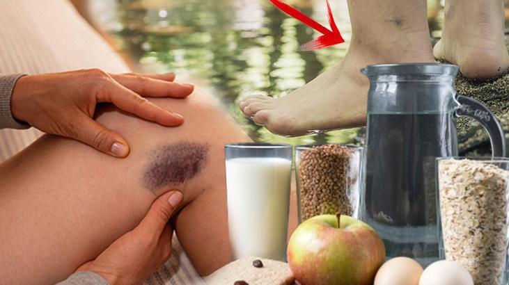 'Gitmeyen kilo' değil, doğrudan hastalık! Milyonlarca kadında var, aynı bölgede yoğunlaşıyor