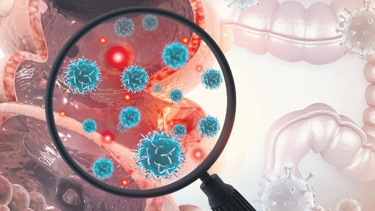 Türkiye’de her yıl 22 bin kişi kolon kanseri oluyor