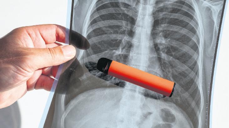 ‘E-sigaralar, DNA zincirini bozuyor’