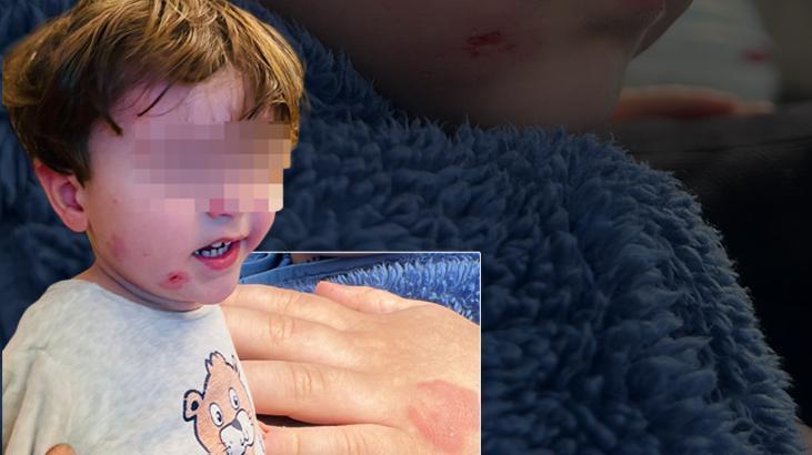Özel kreşte skandal olay! 2,5 yaşındaki çocuk darp edildi