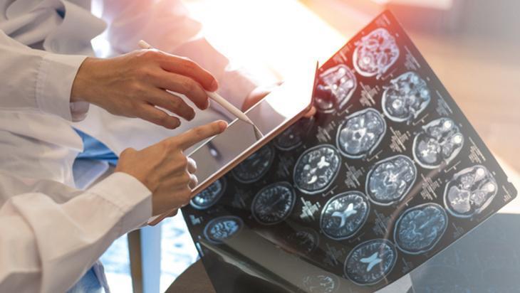 Saatlerce oturmak beyni sessizce tehdit ediyor! Demans riskinde çarpıcı artış