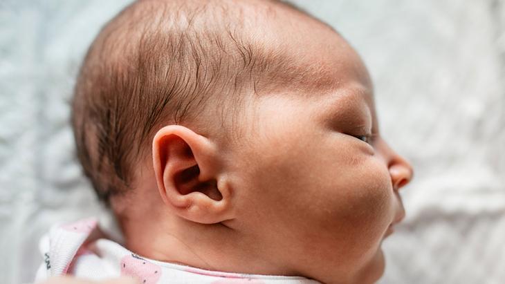 Kepçe kulak, özgüven sorunlarına yol açıyor! Ameliyatsız da tedavisi mümkün