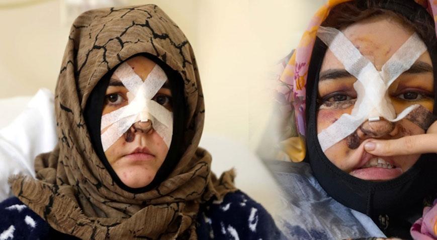 Kaldırım taşıyla dehşet! Mahkemeden kritik karar: Boş arazideki taşlara çarpmıştır