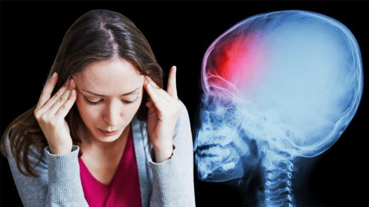 Sıradan sandı, hayatı değişti! Baş ağrısı beyin kanaması çıktı