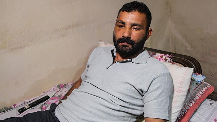 Adana’da işçi 12 metreden düştü! Hayat mücadelesi veriyor: